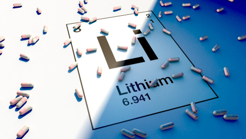 今、最も軽量な金属を買うべき3つの理由